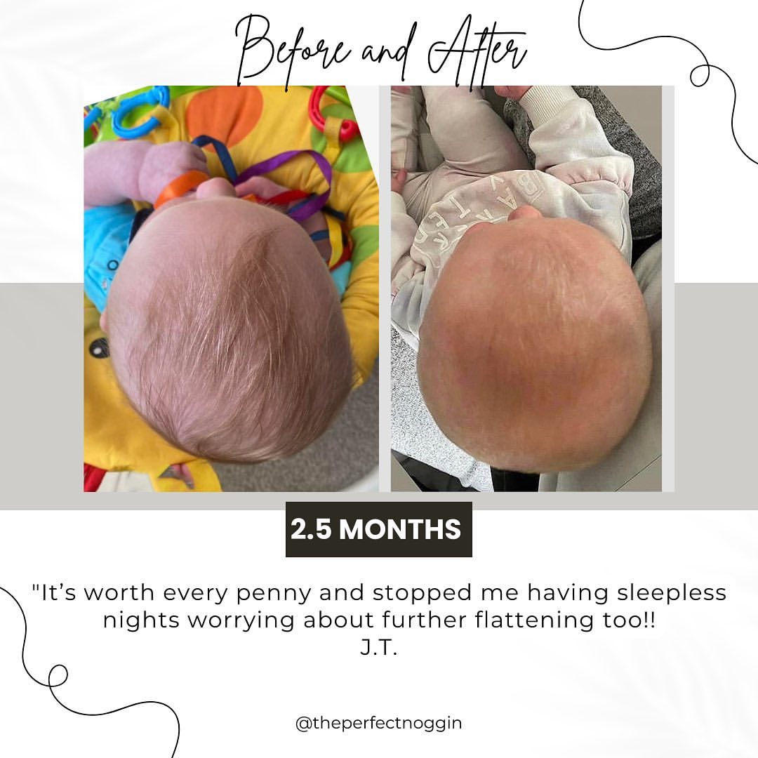 Perfect Noggin Head Shaping Mattress