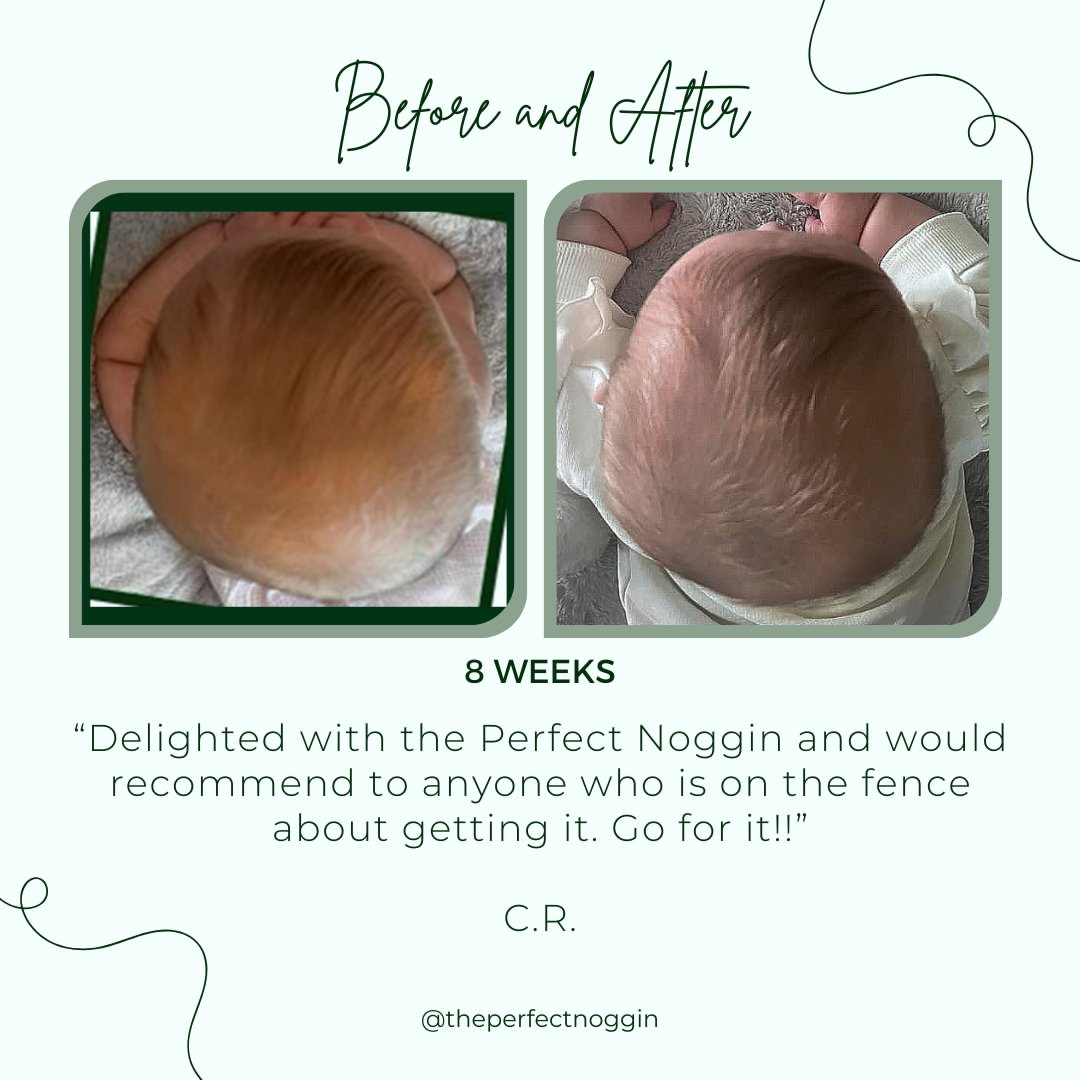 Perfect Noggin Head Shaping Mattress