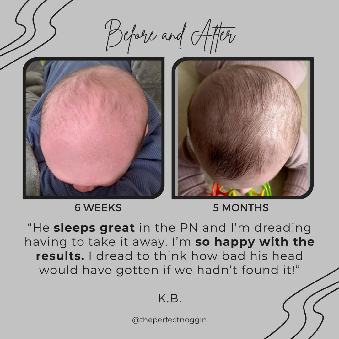 Perfect Noggin Head Shaping Mattress