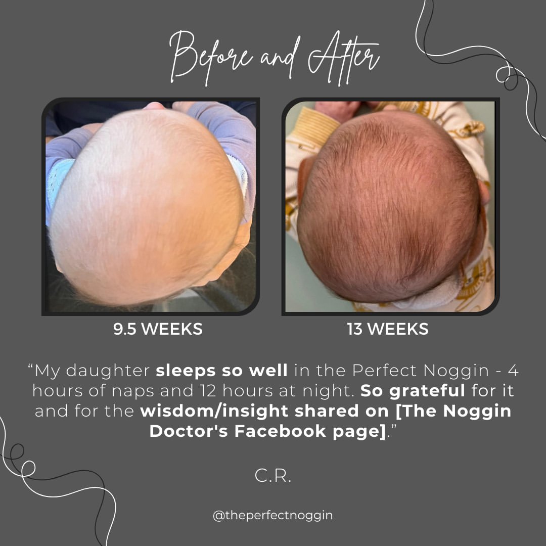 Perfect Noggin Head Shaping Mattress