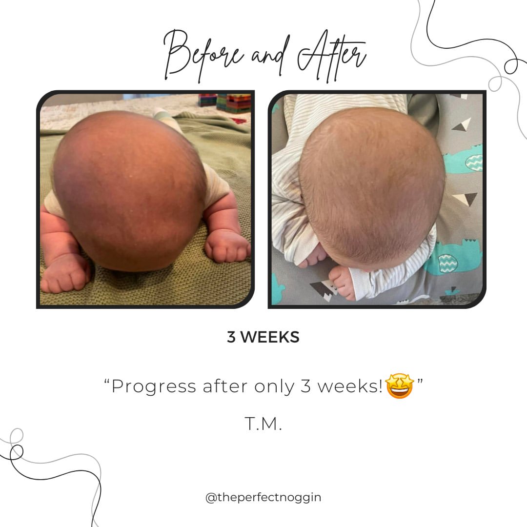 Perfect Noggin Head Shaping Mattress