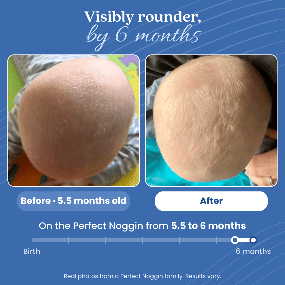 Before and after photos of a baby's head, from 5.5 months old to 6 months on the Perfect Noggin