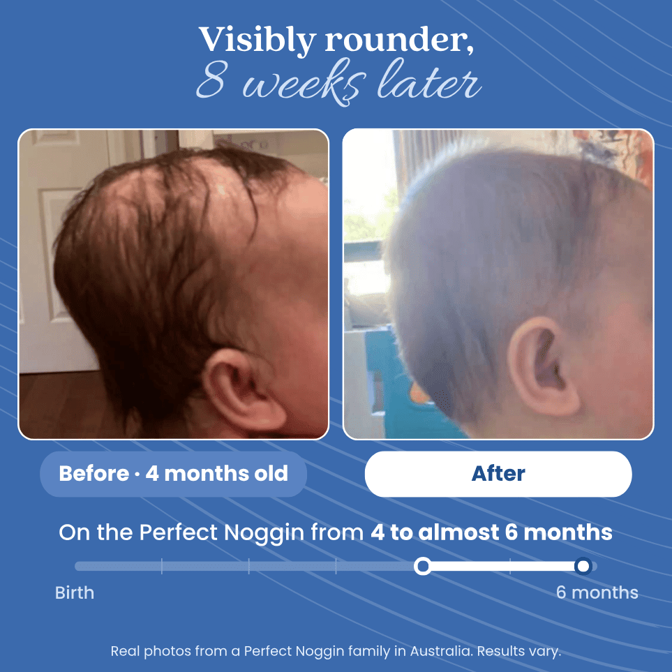 Before and after photos of a baby's head, from 4 months old to almost 6 months on the Perfect Noggin